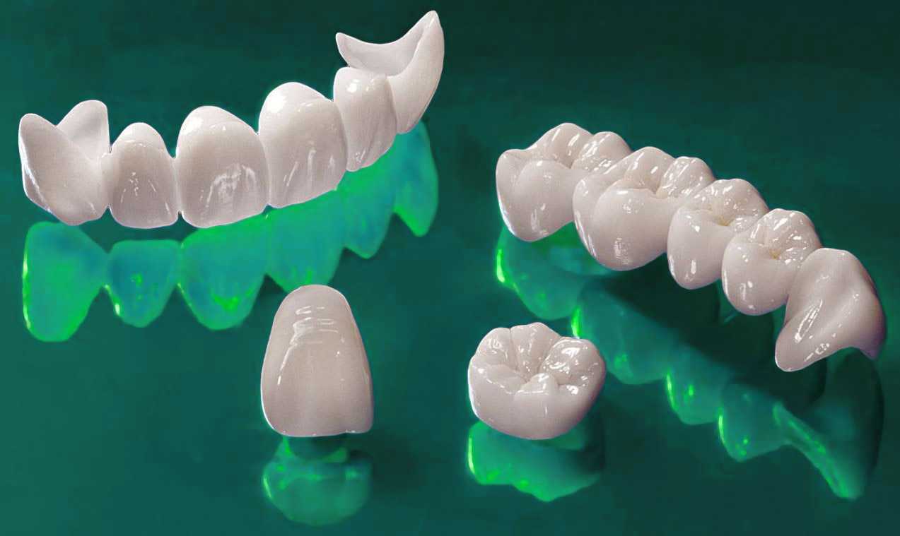 Новые технологии протезирования зубов: современные методы протезирования стоматологии медикастом
