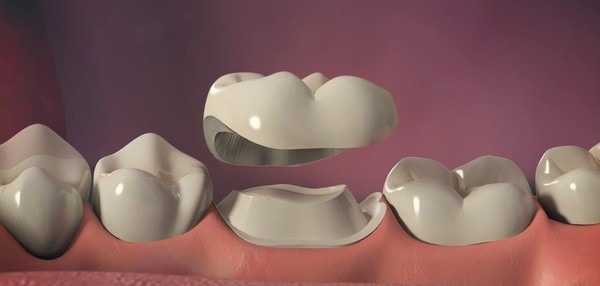 Протезирование зубов: виды и методы протезирования, цены, отзывы, фото