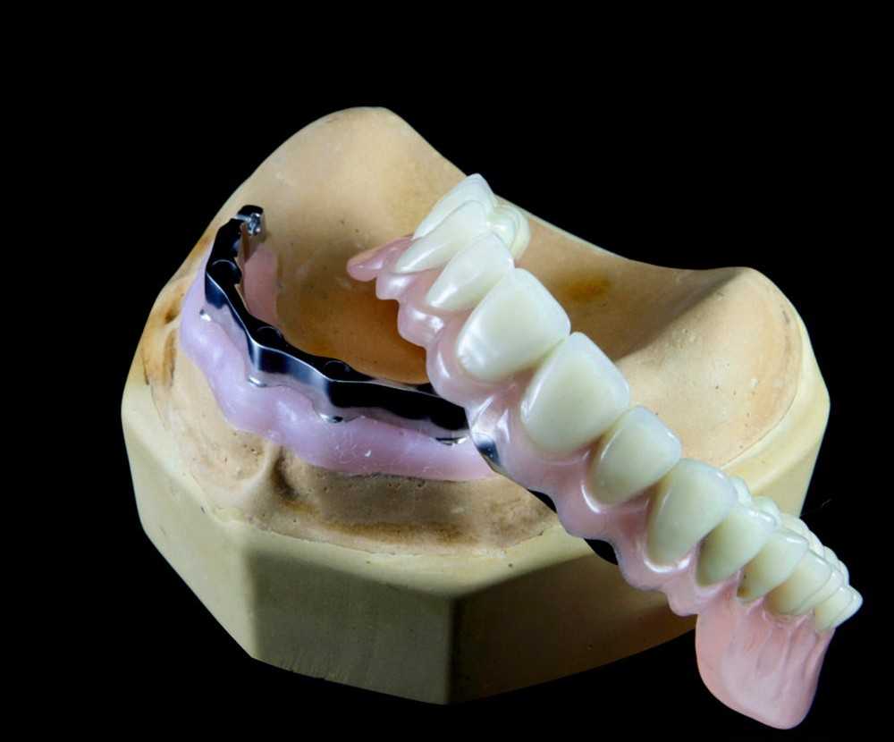 Новые технологии протезирования зубов: современные методы протезирования стоматологии медикастом