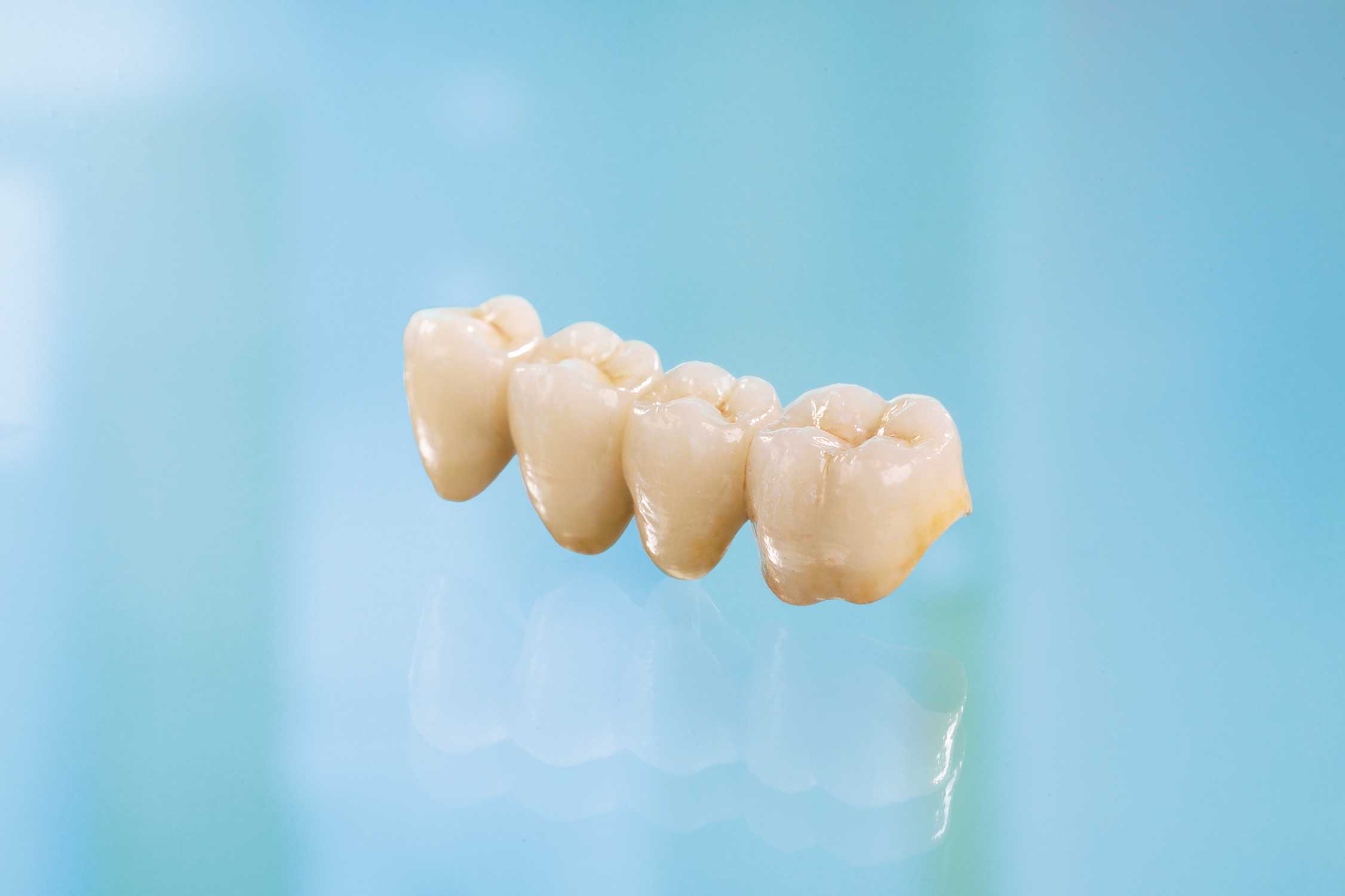 Протезирование зубов на современном уровне | стоматология цэлт