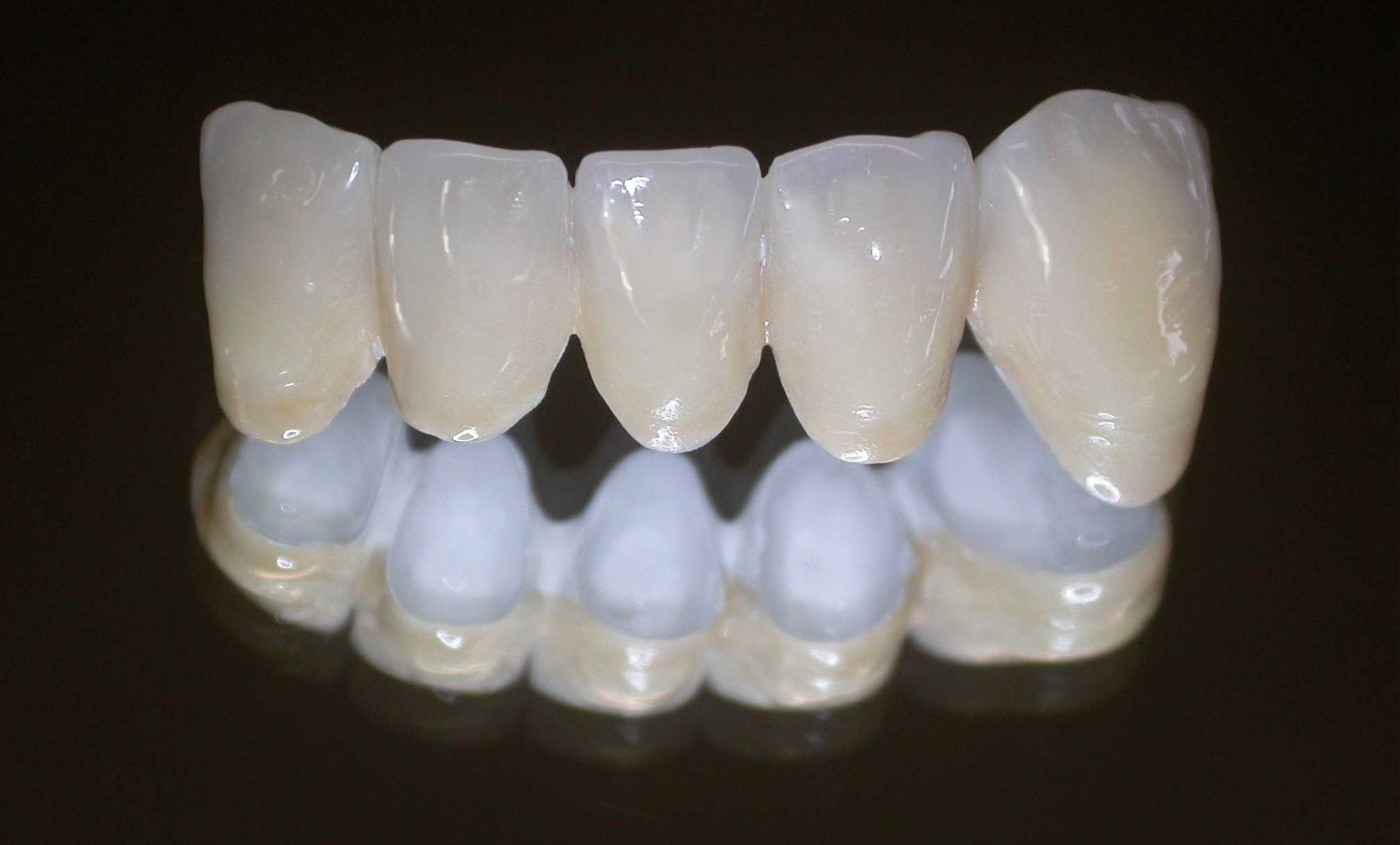 Протезирование зубов недорого: по полису омс, недорогие съемные протезы, недорогие несъемные протезы