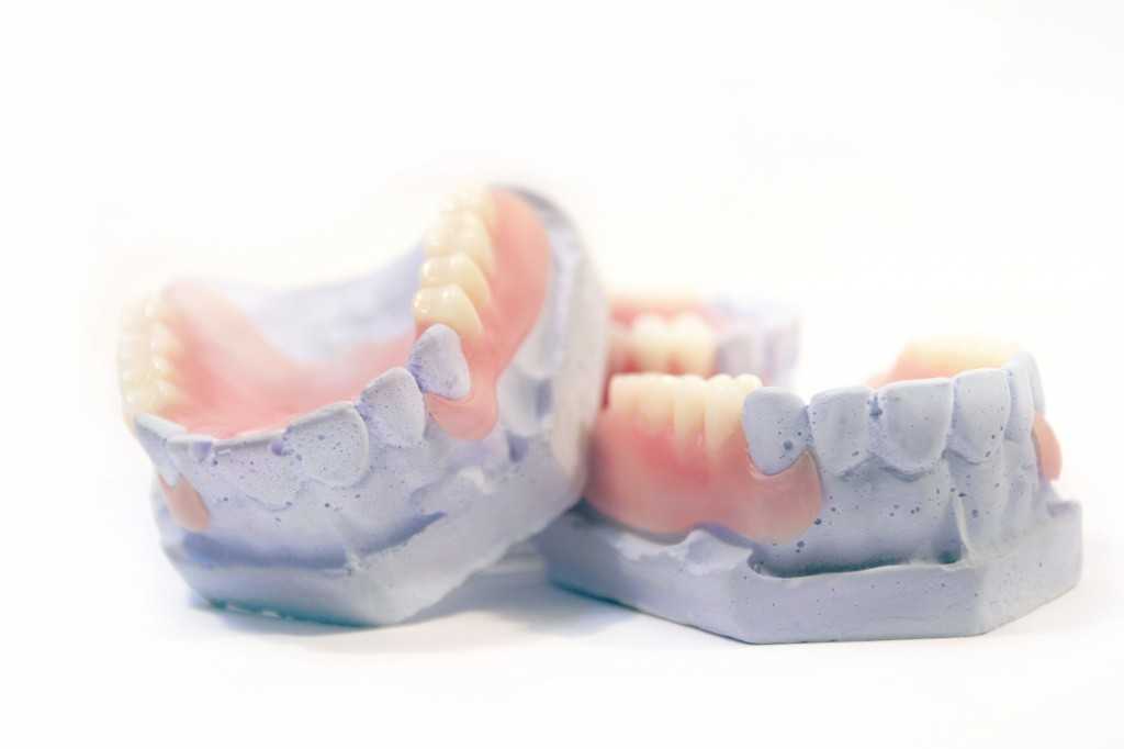 Сравнение съемных зубных протезов - установка, изготовление