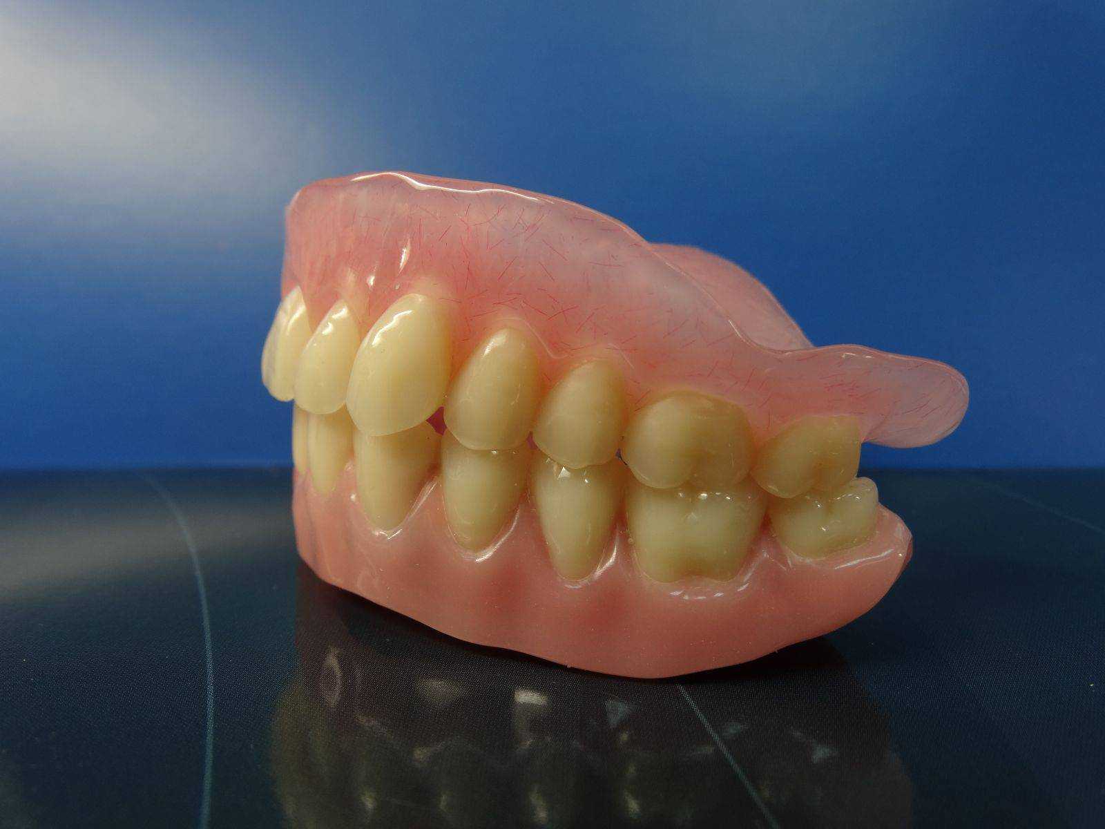 Современные методы протезирование зубов