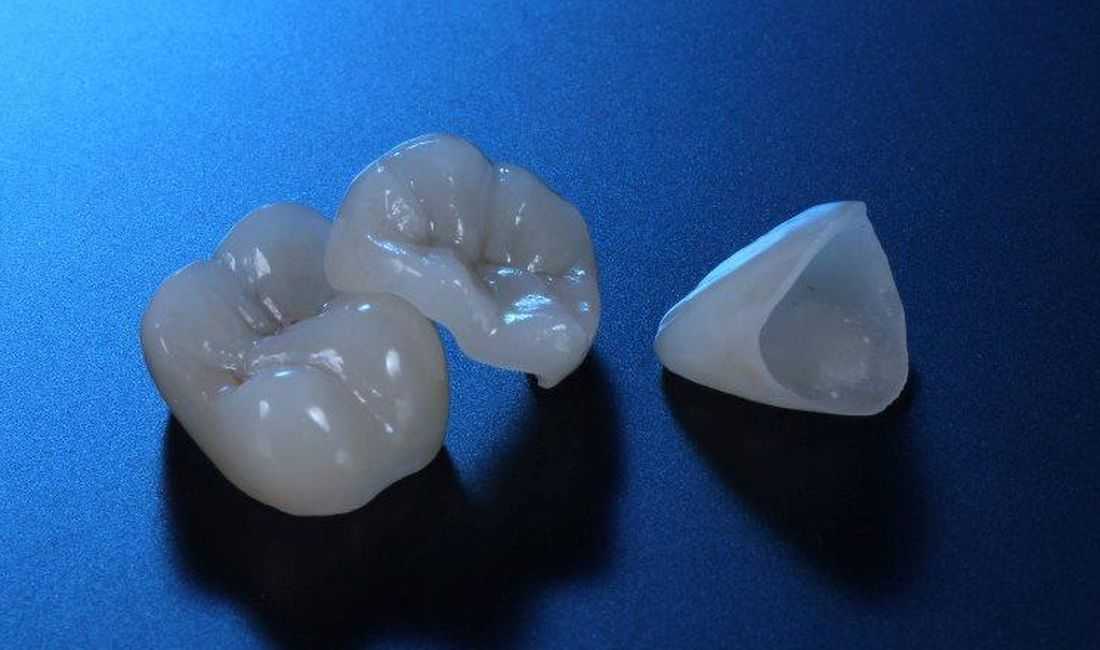 Бесплатное протезирование зубов: кто имеет право, какие услуги, где проводятся, когда можно воспользоваться